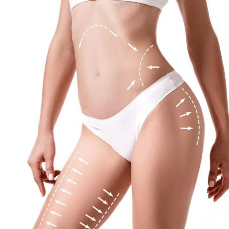 dr. yalcin leymuncicegi pilastik cerrah liposuction tedavi gorselleri